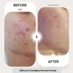 ΚΕΝΤΡΟ-ΑΙΣΘΗΤΙΚΗΣ-ΣΑΛΑΜΙΝΑ-BEAUTY-STYLE-ΚΑΡΒΕΛΑ