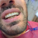 ΧΕΙΡΟΥΡΓΟΣ-ΟΔΟΝΤΙΑΤΡΟΣ-ΒΥΡΩΝΑΣ-ΡΕΜΙΓΙΑΚΗΣ-ΠΑΝΑΓΙΩΤΗΣ