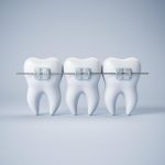 ΟΡΘΟΔΟΝΤΙΚΟΣ-ΧΑΛΚΙΔΑ-ΣΦΥΡΙΔΗΣ-ΣΤΑΥΡΟΣ