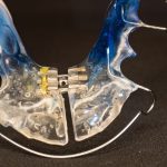 ΟΔΟΝΤΟΤΕΧΝΙΤΗΣ-ΠΑΤΡΑ-ΠΑΝΑΓΙΩΤΟΠΟΥΛΟΣ-ΓΕΩΡΓΙΟΣ