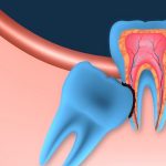 ΧΕΙΡΟΥΡΓΟΣ-ΟΔΟΝΤΙΑΤΡΟΣ-ΠΑΛΑΙΟ-ΦΑΛΗΡΟ-ΤΣΑΧΟΥΡΙΔΗ