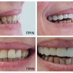 ΧΕΙΡΟΥΡΓΟΣ-ΟΔΟΝΤΙΑΤΡΟΣ-ΠΑΛΑΙΟ-ΦΑΛΗΡΟ-ΤΣΑΧΟΥΡΙΔΗ