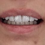 ΧΕΙΡΟΥΡΓΟΣ-ΟΔΟΝΤΙΑΤΡΟΣ-ΠΑΛΑΙΟ-ΦΑΛΗΡΟ-ΤΣΑΧΟΥΡΙΔΗ