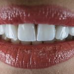 ΧΕΙΡΟΥΡΓΟΣ-ΟΔΟΝΤΙΑΤΡΟΣ-ΠΑΛΑΙΟ-ΦΑΛΗΡΟ-ΤΣΑΧΟΥΡΙΔΗ