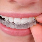 ΧΕΙΡΟΥΡΓΟΣ-ΟΔΟΝΤΙΑΤΡΟΣ-ΠΑΛΑΙΟ-ΦΑΛΗΡΟ-ΤΣΑΧΟΥΡΙΔΗ