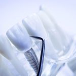 ΧΕΙΡΟΥΡΓΟΣ-ΟΔΟΝΤΙΑΤΡΟΣ-ΗΡΑΚΛΕΙΟ-ΔΙΑΜΑΝΤΟΠΟΥΛΟΥ