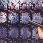 ΝΕΥΡΟΛΟΓΟΣ-ΠΥΡΓΟΣ-ΦΡΙΜΑ-ΜΑΛΑΜΩ