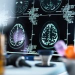 ΝΕΥΡΟΛΟΓΟΣ-ΠΥΡΓΟΣ-ΦΡΙΜΑ-ΜΑΛΑΜΩ