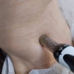 ΚΕΝΤΡΟ-ΑΙΣΘΗΤΙΚΗΣ-ΧΛΟΗ-ΚΑΣΤΟΡΙΑΣ-ΤΑΤΣΗ-ΑΡΕΤΗ