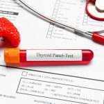 ΕΝΔΟΚΡΙΝΟΛΟΓΟΣ-ΝΕΑ-ΜΟΥΔΑΝΙΑ-ΠΑΤΑΡΗ-ΦΩΤΕΙΝΗ