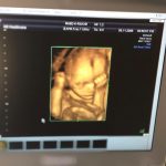 ΓΥΝΑΙΚΟΛΟΓΟΣ-ΠΑΡΑΛΙΑ-ΚΑΤΕΡΙΝΗΣ-ΚΩΝΣΤΑΝΤΙΝΟΥ