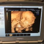 ΓΥΝΑΙΚΟΛΟΓΟΣ-ΠΑΡΑΛΙΑ-ΚΑΤΕΡΙΝΗΣ-ΚΩΝΣΤΑΝΤΙΝΟΥ