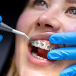 ΕΙΔΙΚΟΣ-ΟΡΘΟΔΟΝΤΙΚΟΣ-ΧΑΝΙΑ-ΡΑΪΣΑΚΗΣ