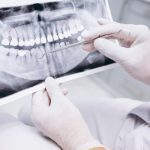 ΟΔΟΝΤΙΑΤΡΟΣ-ΚΑΛΑΜΡΙΑ-ΘΕΣΣΑΛΟΝΙΚΗΣ-ΜΙΝΑΡΕΤΖΗ