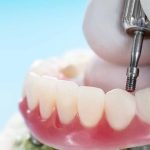 ΟΔΟΝΤΙΑΤΡΟΣ-ΚΑΛΑΜΡΙΑ-ΘΕΣΣΑΛΟΝΙΚΗΣ-ΜΙΝΑΡΕΤΖΗ